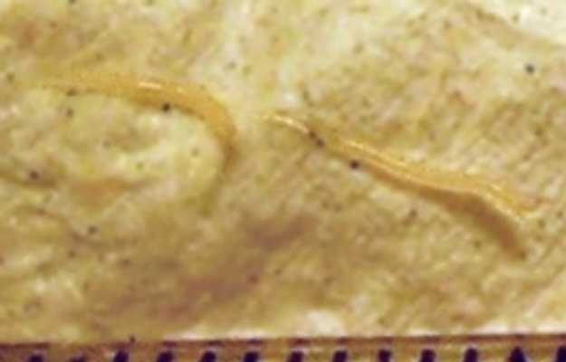 hogy a pinworms nem szereti