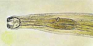 aszcariasis trichocephalosis enterobiosis hookworm és necatorosis anyag a parazitákról