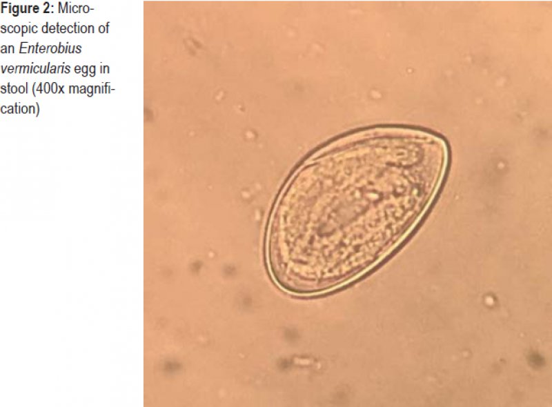pinworms a második trimeszterben