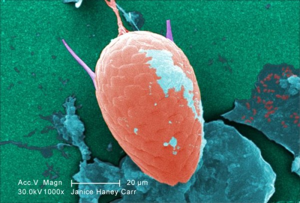 giardia well water)