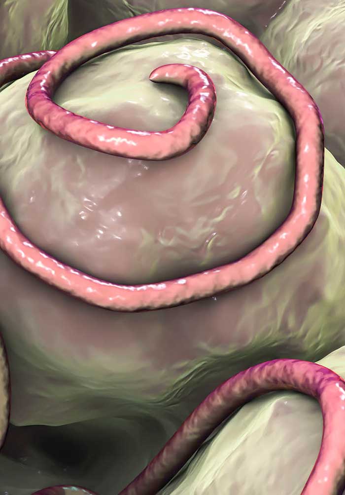 a helminthiasis intravitalis és posztumális diagnosztizálása