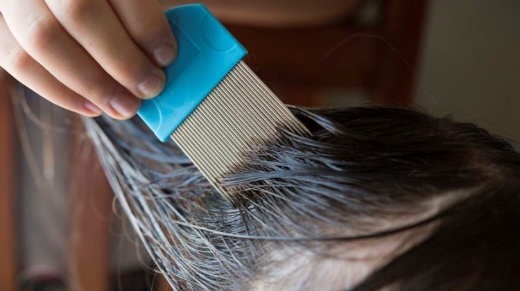 paraziták befolyásolják a bőrt)