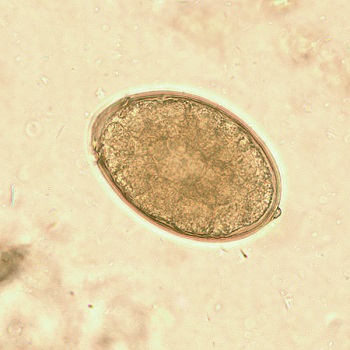 A diphyllobothriasis biohelminth)