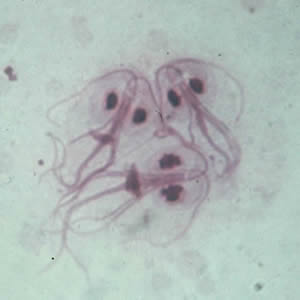 Microsporum canis | Canis, Medical, Clinic - Giardia cdc treatment