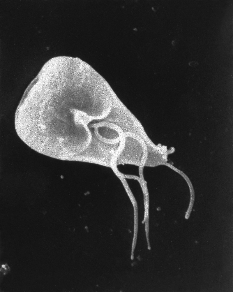 giardiasis antibiotics)