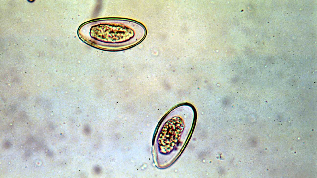 Pinworms csecsemőknél tünetek. A fertőzés fertőzés tünetei a gyermekekben. Enterobiasis kezelése