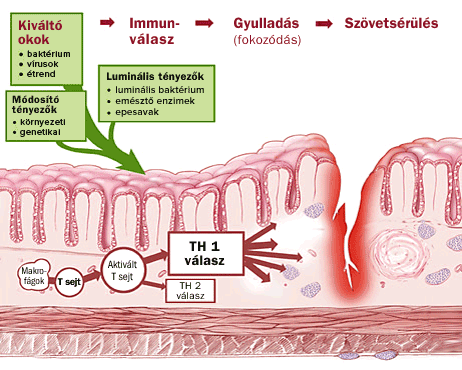 Crohn- betegség helminth kezelése