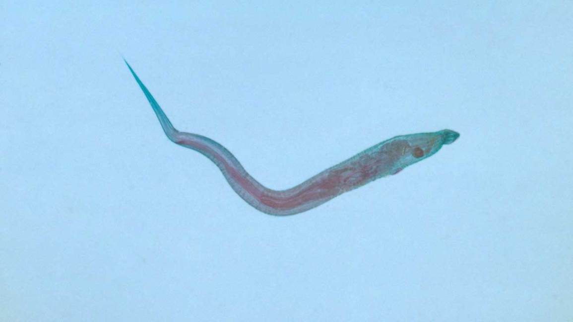 a pinworm férgek tünetei az embereknél)