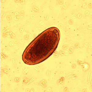 a pinworm tojások élete)