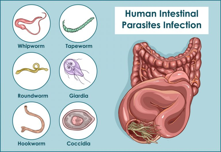 Giardiasis kezelése hazilag. Giardia-fertőzés (giardiasis)