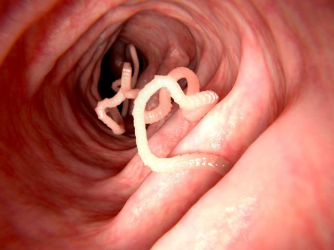 a pinworms a levegőben élnek)
