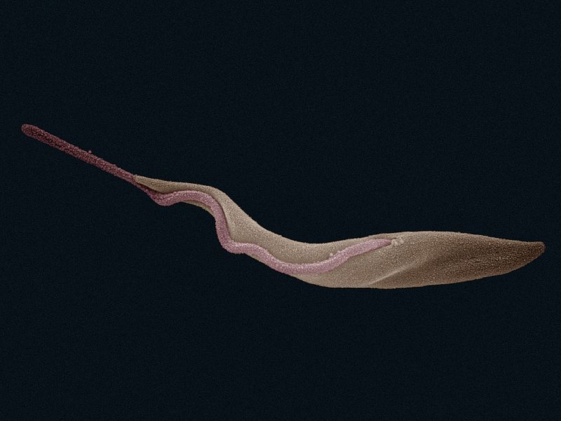 Pinworm a pinworms emberektől