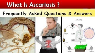 aszcariasis kórokozója