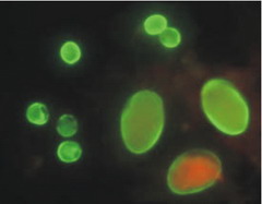 Cdc giardia treatment