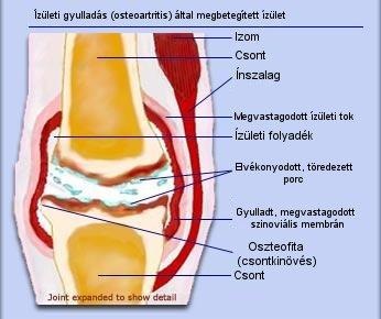 szalagok és ízületek paraziták)