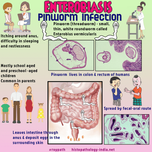 pinworms hogyan lehet diagnosztizálni)