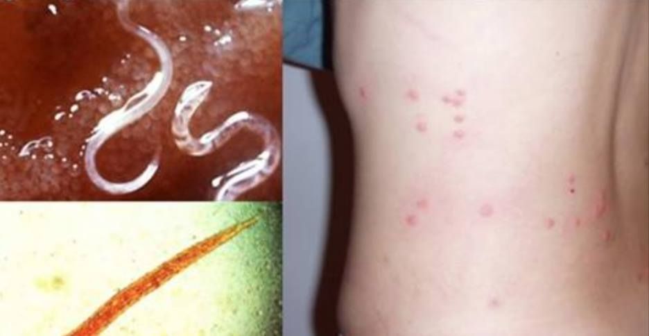 Orvos válaszol fórum szabályzat - schirilla.hu Pinworms orvosok fóruma