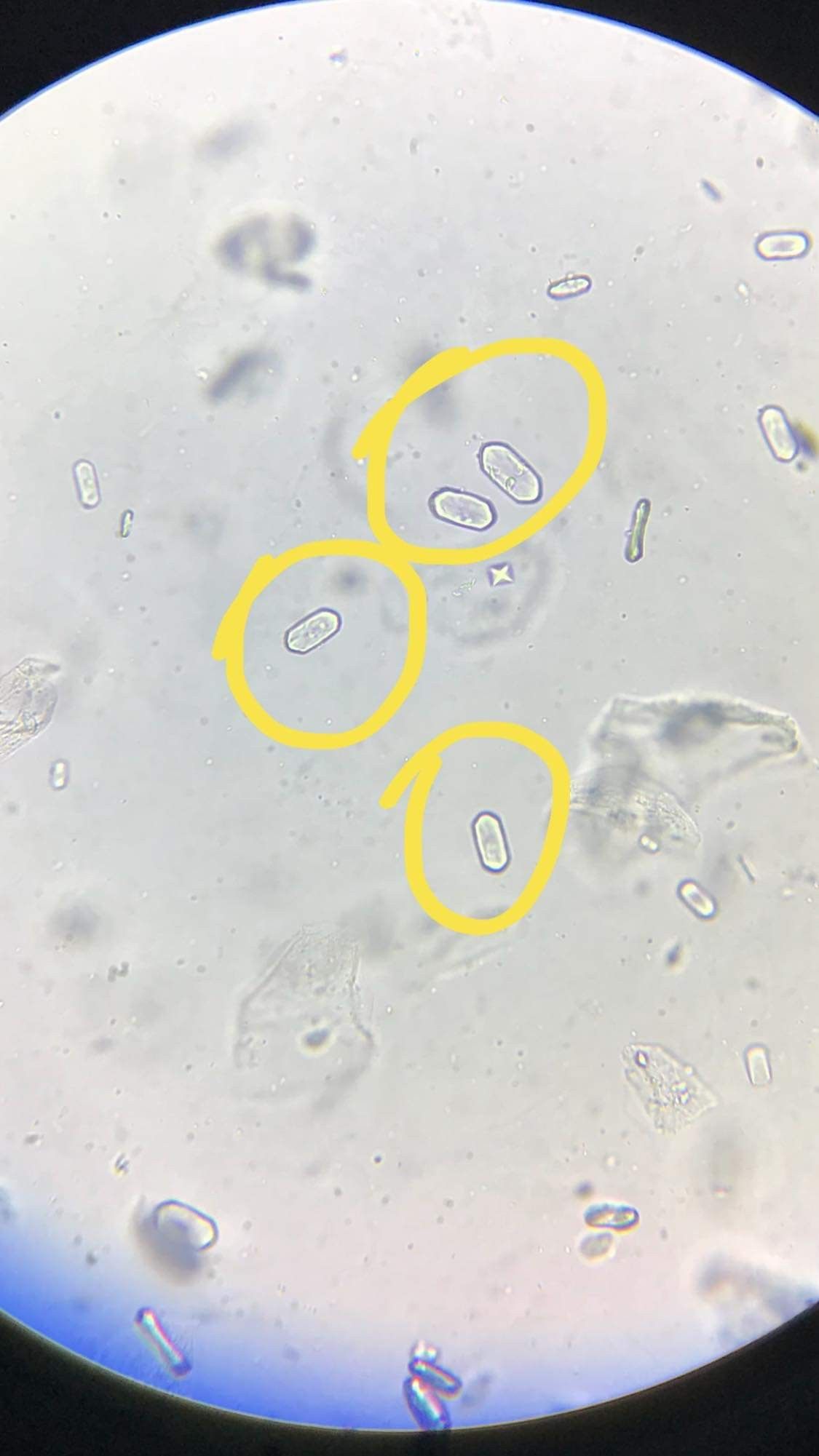 Pinworms gyakran megjelennek egy gyermek