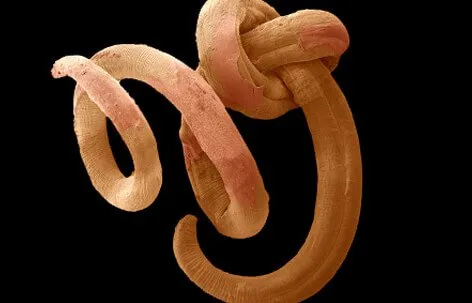 Pinworms a tüdőben és az orrban - A testen , A pinworms bejuthat a női szervekbe