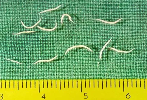 mind a pinworm fertőzésről