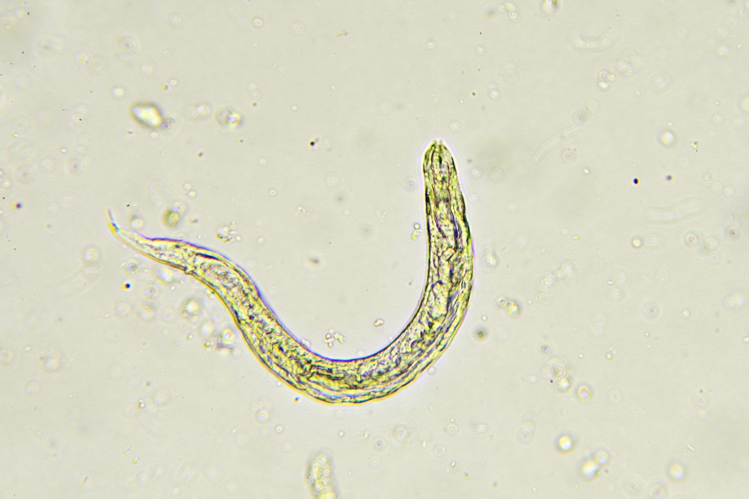 Pinworms allergia