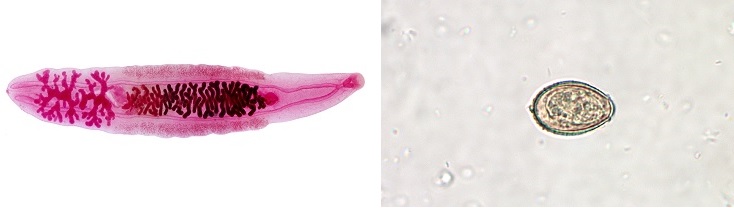 clonorchiasis parazita