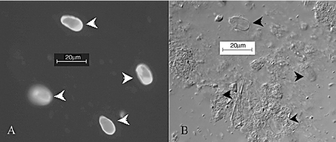 tisztító a test + Giardia - schirilla.hu - Test x giardia
