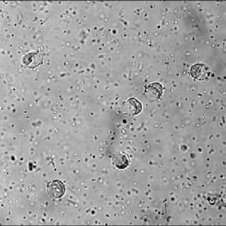 Giardiasis tünetei és kezelése Giardia cysts 3
