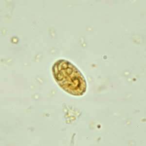 giardia lambdia)