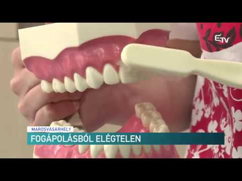 Miért álmodoznak a fehér átlátszó férgek,
