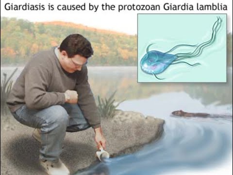 férgek giardiasis tünetei