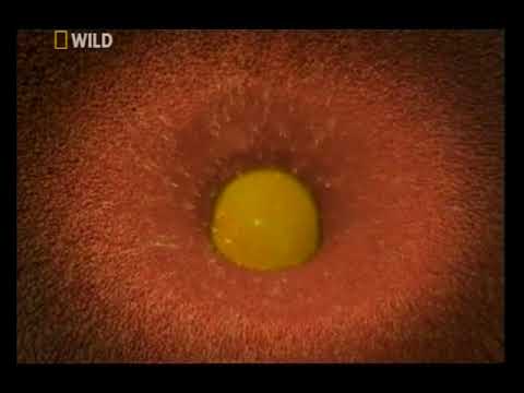 Pinworms az őröknél