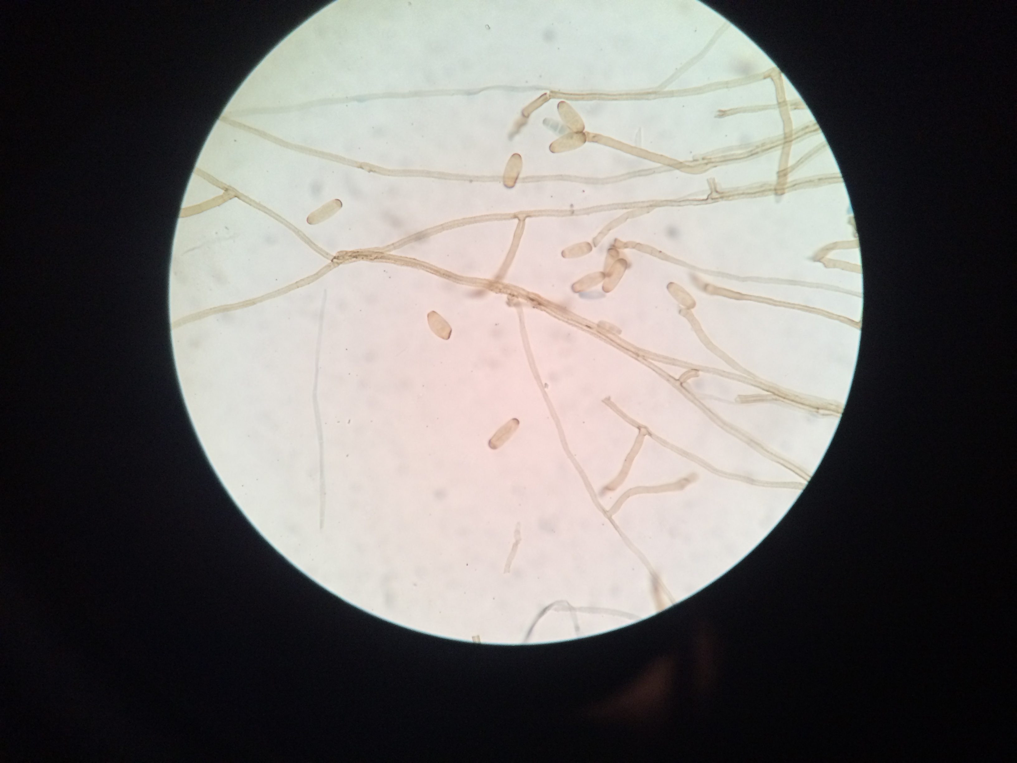 Helminthosporium spicifera, Helminthosporium spicifera