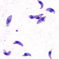 toxoplazmózis parazita