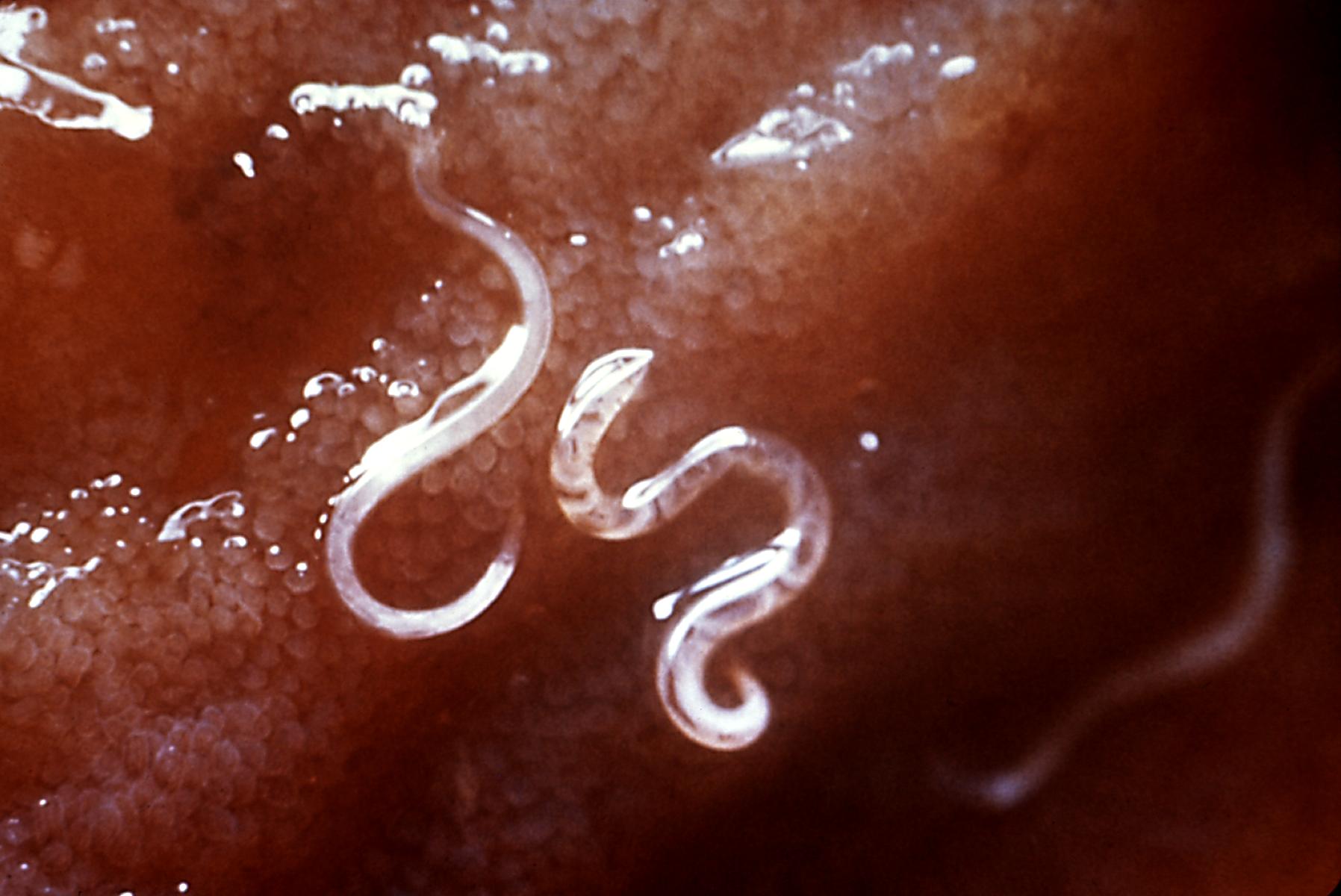aszcariasis enterobiosis hookworm necatorosis trichocephalosis
