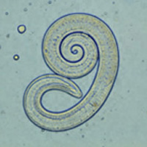 A Trichinella egy féreg)