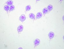 giardiasis aura