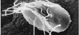 giardia bij mensen symptomen)