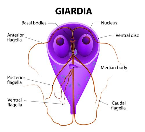 untreated giardiasis